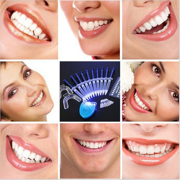 Teeth Whitening Kit 50% off this week
